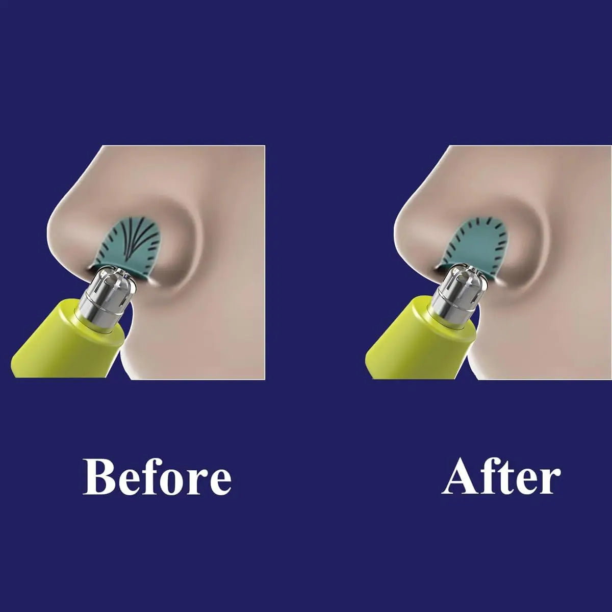 Replacement Blades for Philips OneBlade
